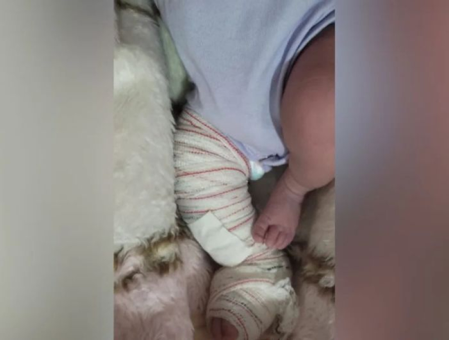 Bebê sofre fratura na perna durante parto em hospital na Serra, denuncia mãe