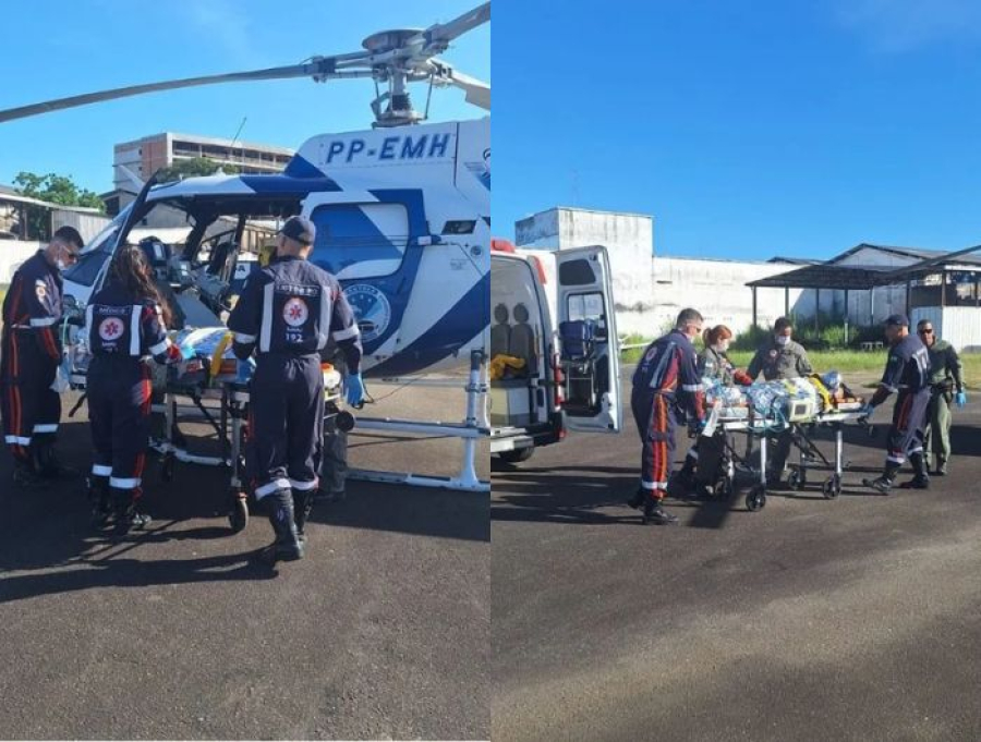 Mulher tem 38% do corpo queimado ao acender churrasqueira com álcool em Guarapari